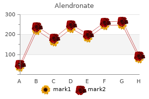 discount alendronate 70 mg without a prescription