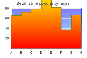 order betahistine 16 mg fast delivery