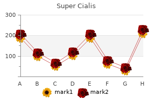 super cialis 80mg mastercard