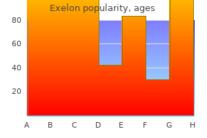 order exelon 3 mg without a prescription