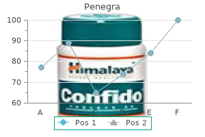 order penegra 100mg online