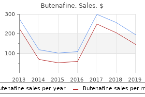 cheap butenafine 15 mg on line