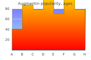 Buy Cheap Augmentin
