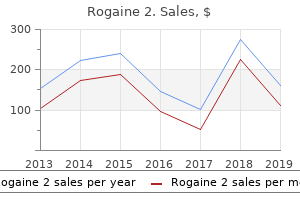 generic 60 ml rogaine 2 with mastercard