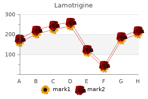 buy lamotrigine 50mg cheap