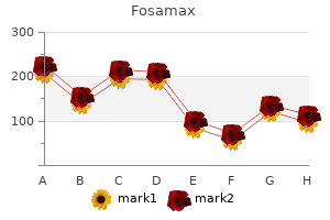 buy cheap fosamax 35 mg line