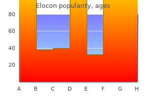 safe elocon 5g