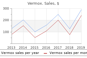 buy vermox 100mg on line